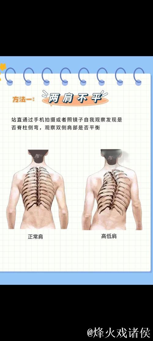 1分钟科普站丨预防青少年脊柱侧弯 这2个动作太管用了 1分钟科普站丨预防青少年脊柱侧弯 这2个动作太管用了